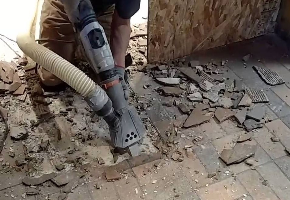 STONE REMOVAL